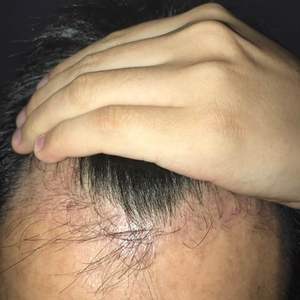 发际线分享社区