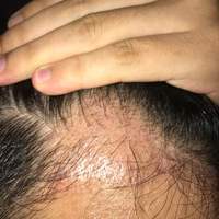 發(fā)際線用戶圖片