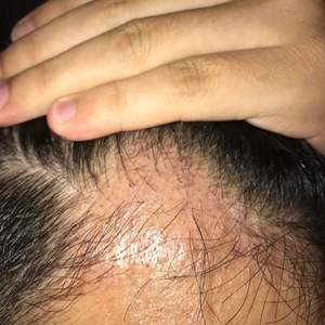 发际线分享社区