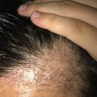 發(fā)際線用戶圖片