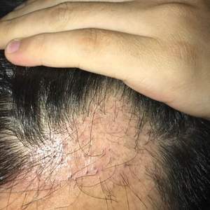 发际线分享社区