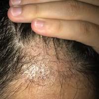 發(fā)際線用戶圖片