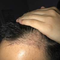 發(fā)際線用戶圖片