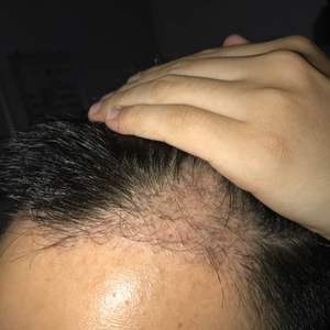 发际线分享社区