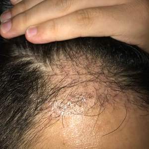 发际线分享社区
