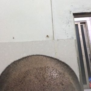 发际线分享社区