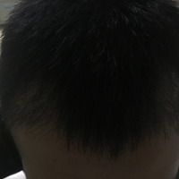 發(fā)際線用戶圖片