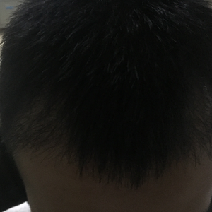 发际线分享社区
