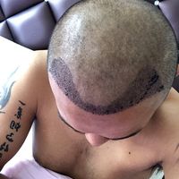 發(fā)際線用戶圖片