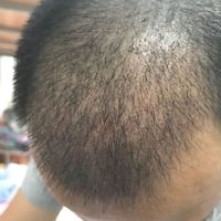 發(fā)際線用戶圖片