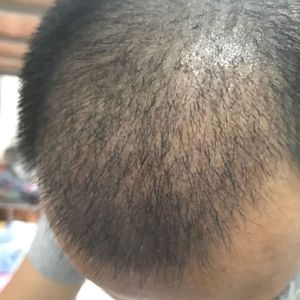 发际线分享社区