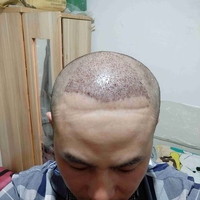 發(fā)際線用戶圖片