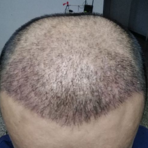 发际线分享社区