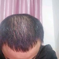 發(fā)際線用戶圖片