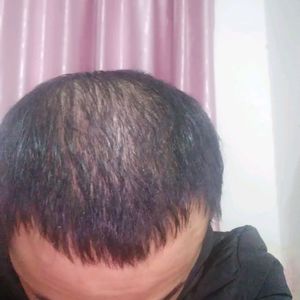 发际线分享社区