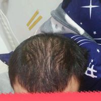 發(fā)際線用戶圖片
