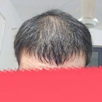 發(fā)際線(xiàn)用戶(hù)圖片