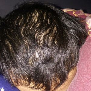 发际线分享社区
