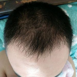 发际线分享社区