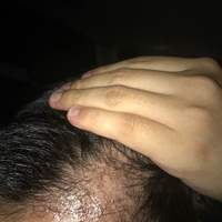 發(fā)際線(xiàn)用戶(hù)圖片