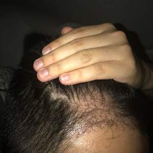 发际线分享社区