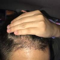 發(fā)際線(xiàn)用戶(hù)圖片