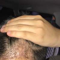 發(fā)際線(xiàn)用戶(hù)圖片