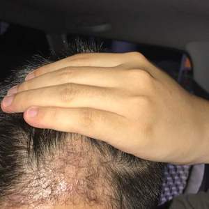 发际线分享社区