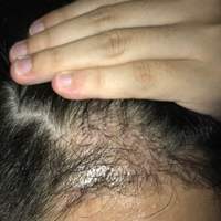 發(fā)際線(xiàn)用戶(hù)圖片