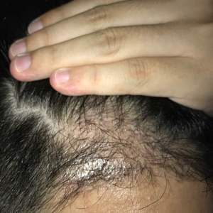 发际线分享社区