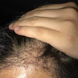 发际线分享社区