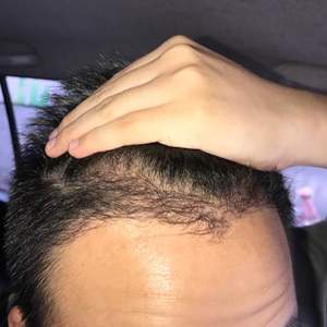 发际线分享社区