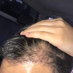 发际线分享社区