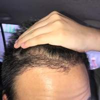 發(fā)際線用戶圖片