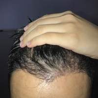 發(fā)際線用戶圖片