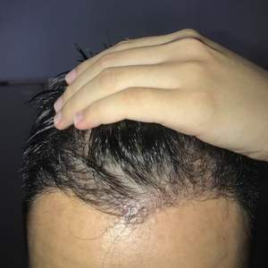 发际线分享社区