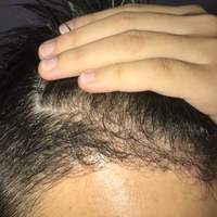 發(fā)際線用戶圖片