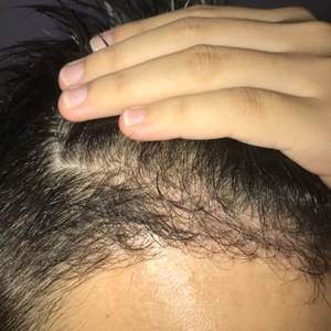发际线分享社区