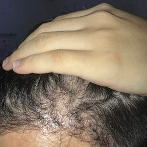 发际线分享社区