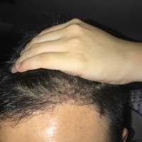 發(fā)際線用戶圖片