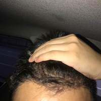 發(fā)際線用戶圖片