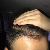 發(fā)際線用戶圖片