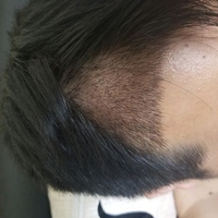 發(fā)際線用戶圖片