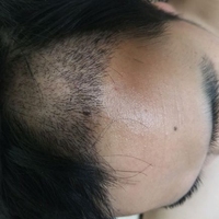 發(fā)際線用戶圖片