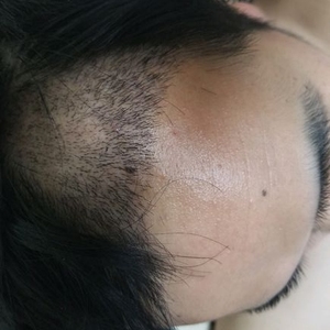 发际线分享社区