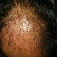 發(fā)際線用戶圖片