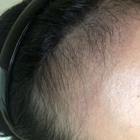 發(fā)際線用戶圖片