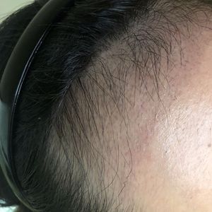 发际线分享社区