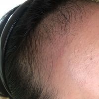 發(fā)際線用戶圖片
