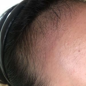 发际线分享社区